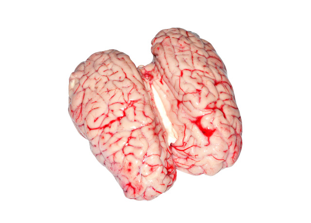Brain