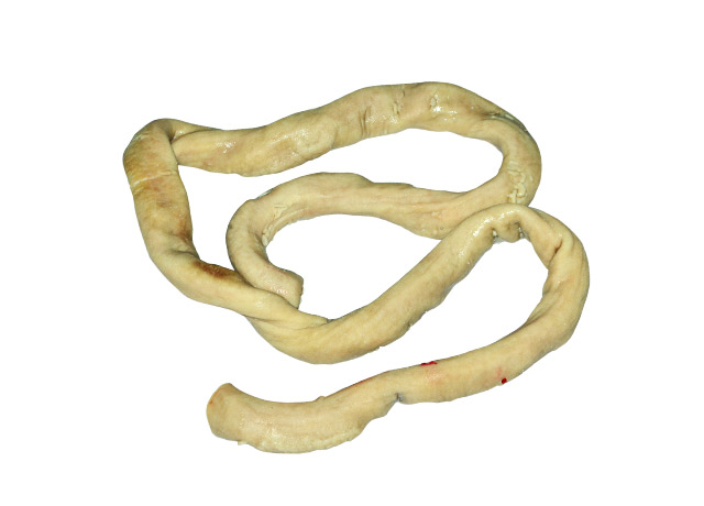 Intestine